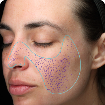 Pore analysis visualization